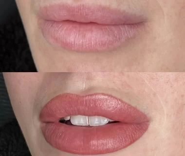 Do You Get Cold Sores After Lip Blush?