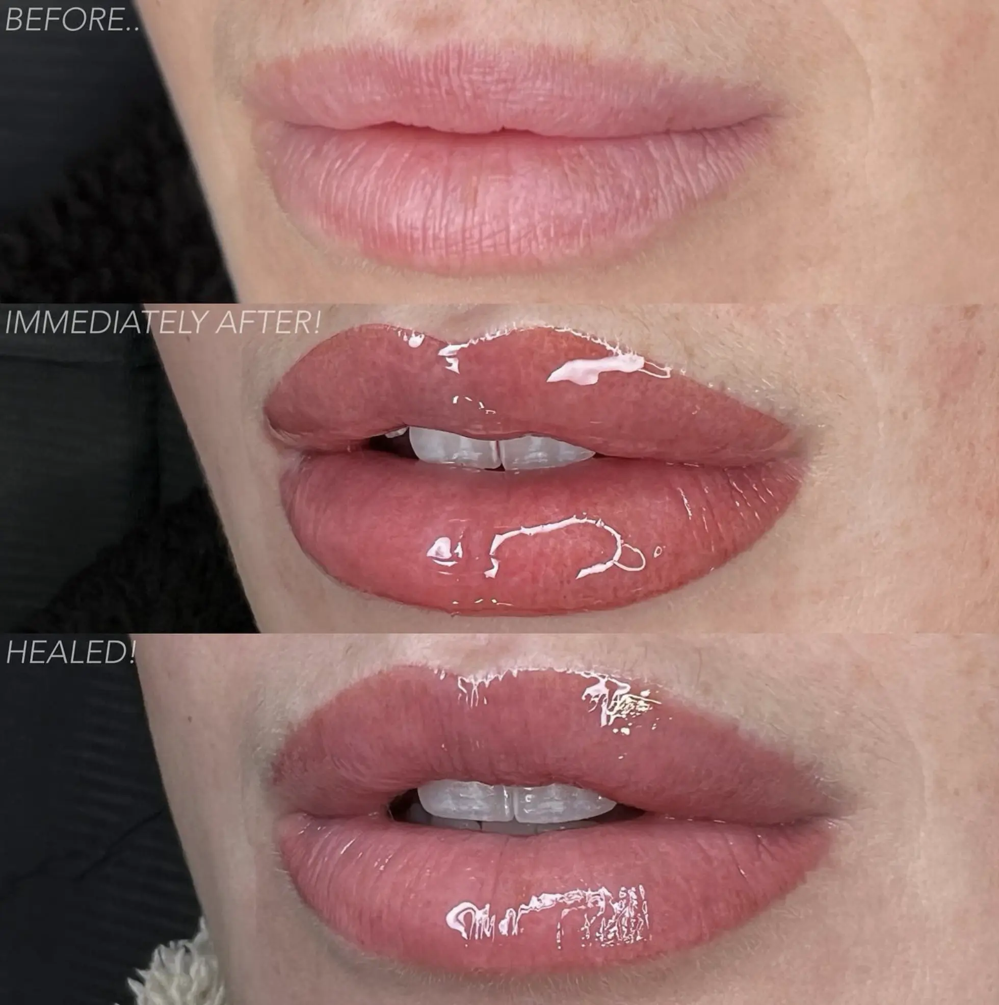 lip tattoo before and after