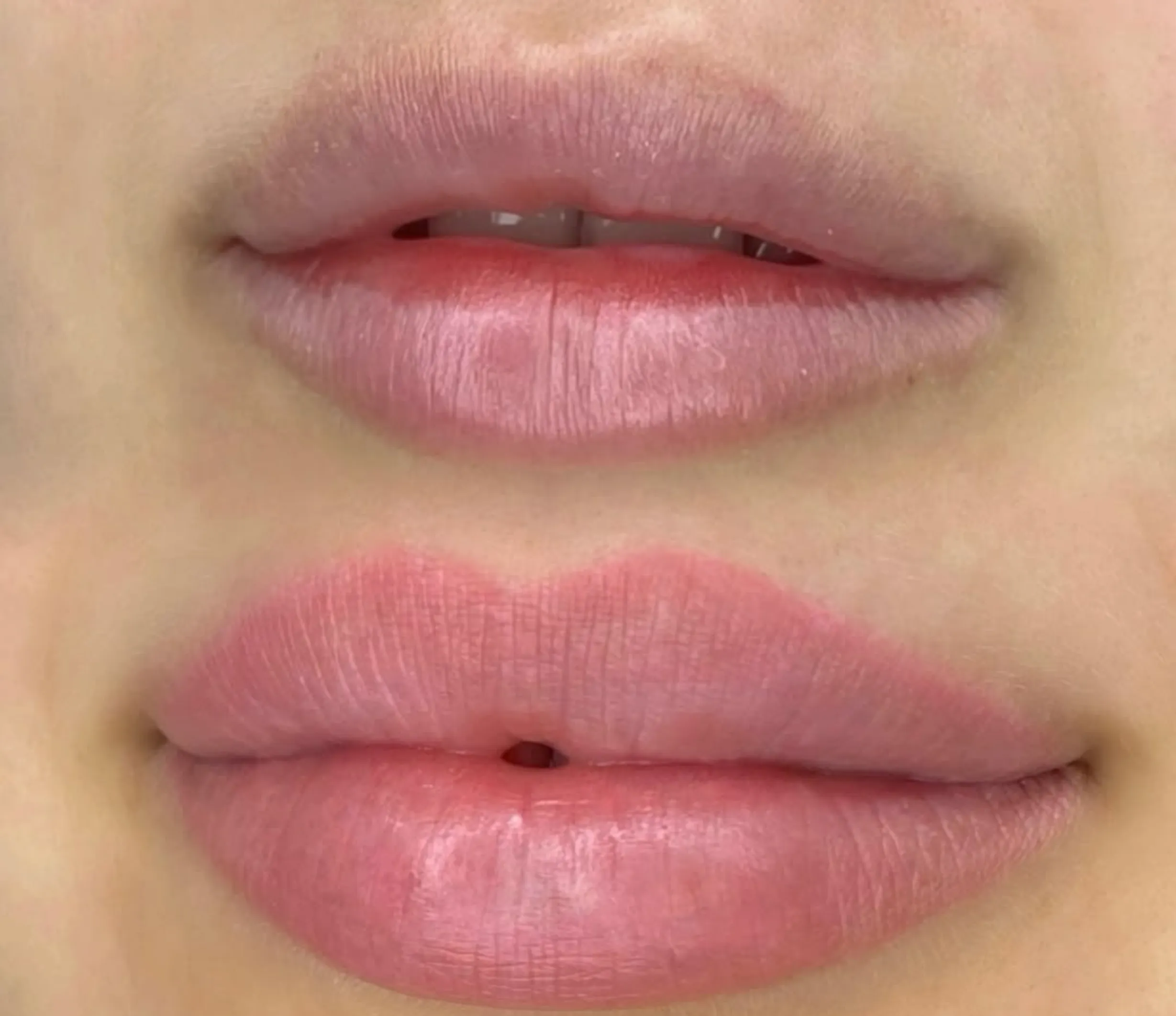 cosmetic tattoo for lips