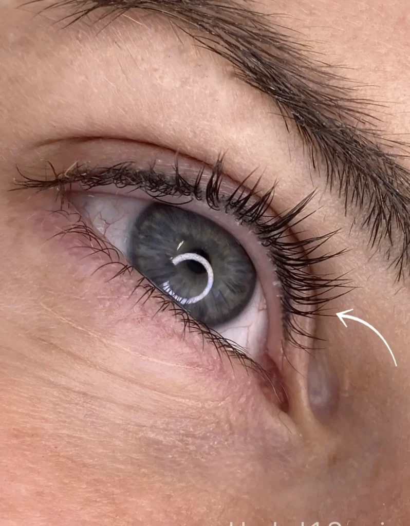 How It Compares To Other Lash Treatments